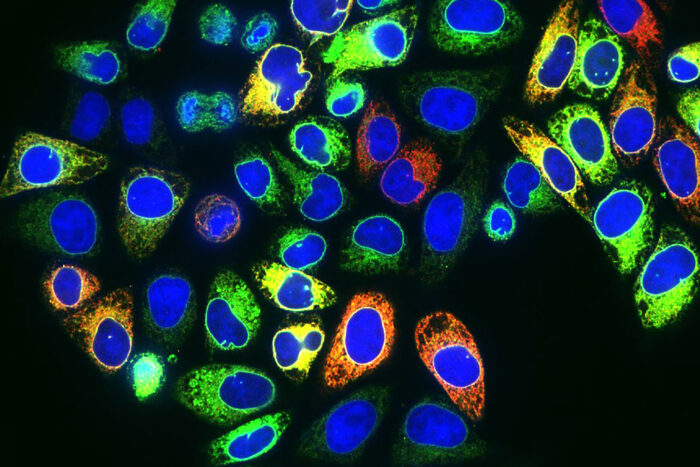 You Lab research highlighted by WUSM News